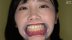 フェチ口：【口腔】人気モデル 角名つむぎチャンの超激レアな歯・口内・のどちんこ・唾観察